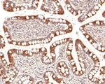 P-Glycoprotein Antibody in Immunohistochemistry (Paraffin) (IHC (P))