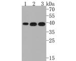 GNB5 Antibody in Western Blot (WB)