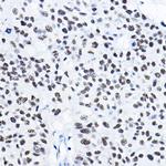 HDAC1 Antibody in Immunohistochemistry (Paraffin) (IHC (P))