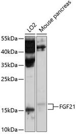 FGF21 Antibody in Western Blot (WB)