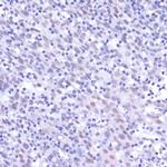 NFkB p50/p105 Antibody in Immunohistochemistry (Paraffin) (IHC (P))
