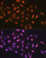 MCM7 Antibody in Immunocytochemistry (ICC/IF)