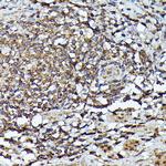 JAK2 Antibody in Immunohistochemistry (Paraffin) (IHC (P))