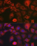 MYO10 Antibody in Immunocytochemistry (ICC/IF)