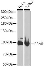 RRM1 Antibody in Western Blot (WB)