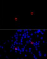 CD299 (DC-SIGN/L) Antibody in Immunocytochemistry (ICC/IF)