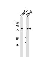 USP22 Antibody in Western Blot (WB)