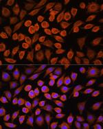 PDP1 Antibody in Immunocytochemistry (ICC/IF)