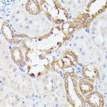 PTP4A2 Antibody in Immunohistochemistry (Paraffin) (IHC (P))