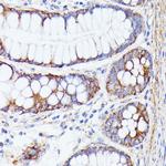 PTP4A2 Antibody in Immunohistochemistry (Paraffin) (IHC (P))