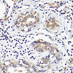 IMPDH2 Antibody in Immunohistochemistry (Paraffin) (IHC (P))