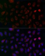 MCU Antibody in Immunocytochemistry (ICC/IF)