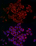 MCU Antibody in Immunocytochemistry (ICC/IF)