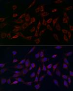 MCU Antibody in Immunocytochemistry (ICC/IF)