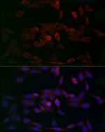 MCU Antibody in Immunocytochemistry (ICC/IF)