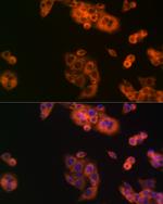 BCAT1 Antibody in Immunocytochemistry (ICC/IF)