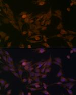 BCAT1 Antibody in Immunocytochemistry (ICC/IF)