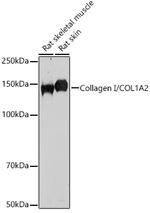 COL1A2 Antibody in Western Blot (WB)