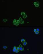CHRM1 Antibody in Immunocytochemistry (ICC/IF)