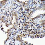 MYH9 Antibody in Immunohistochemistry (Paraffin) (IHC (P))