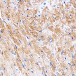 HSPB7 Antibody in Immunohistochemistry (Paraffin) (IHC (P))