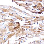 HSPB7 Antibody in Immunohistochemistry (Paraffin) (IHC (P))