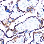 HSPB7 Antibody in Immunohistochemistry (Paraffin) (IHC (P))