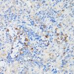 IFNAR1 Antibody in Immunohistochemistry (Paraffin) (IHC (P))