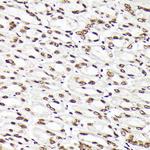 RAD21 Antibody in Immunohistochemistry (Paraffin) (IHC (P))