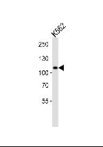 MIB1 Antibody in Western Blot (WB)