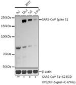 SARS-CoV Spike Protein S1 Antibody in Western Blot (WB)