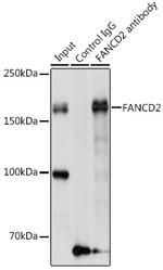 FANCD2 Antibody in Immunoprecipitation (IP)