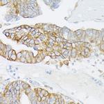 MRP4 Antibody in Immunohistochemistry (Paraffin) (IHC (P))