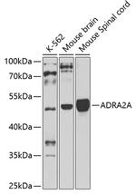 alpha-2a Adrenergic Receptor Antibody in Western Blot (WB)