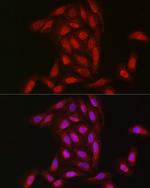 NOTCH3 Antibody in Immunocytochemistry (ICC/IF)
