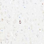 NPY Antibody in Immunohistochemistry (Paraffin) (IHC (P))