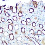 LONP1 Antibody in Immunohistochemistry (Paraffin) (IHC (P))