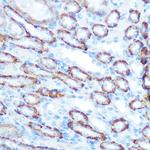 LONP1 Antibody in Immunohistochemistry (Paraffin) (IHC (P))