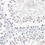 PBK Antibody in Immunohistochemistry (Paraffin) (IHC (P))