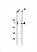 SQSTM1 Antibody in Western Blot (WB)