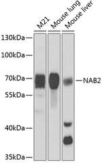 NAB2 Antibody in Western Blot (WB)