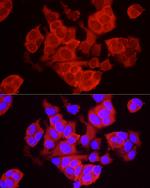 TREX1 Antibody in Immunocytochemistry (ICC/IF)