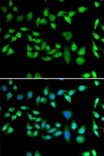 DNAJB6 Antibody in Immunocytochemistry (ICC/IF)