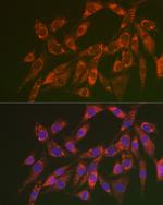 CHMP4B Antibody in Immunocytochemistry (ICC/IF)
