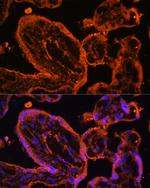 LDB3 Antibody in Immunocytochemistry (ICC/IF)