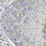 TROP2 Antibody in Immunohistochemistry (Paraffin) (IHC (P))