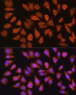 IMPDH1 Antibody in Immunocytochemistry (ICC/IF)