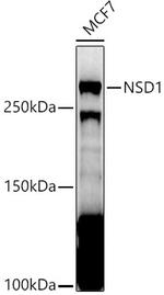 NSD1 Antibody in Western Blot (WB)