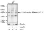 Phospho-PKA alpha (Thr197) Antibody in Western Blot (WB)