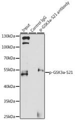 Phospho-GSK3 alpha (Ser21) Antibody in Immunoprecipitation (IP)